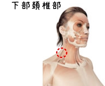 線維筋痛症について