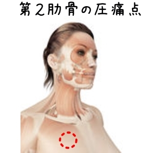 線維筋痛症について